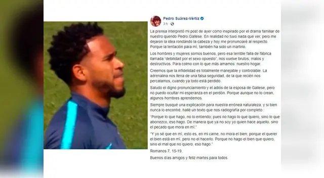 Músico peruano opinó sobre ampay de Gallese Músico peruano opinó sobre ampay de Gallese