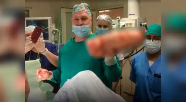 Hombre ingresó al hospital por dolores de estómago porque tenía en su interior un consolador