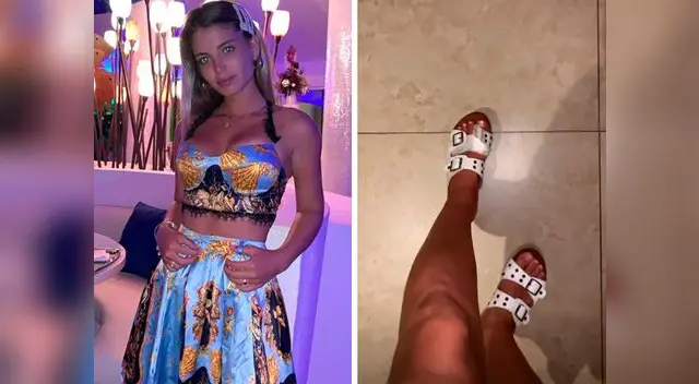 Flavia Laos terminó con corte profundo en el dedo y fue atendida de emergencia