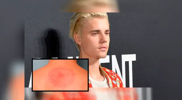 Justin Bieber vive uno de sus momentos más complicados, y así lo informó a sus seguidores. Justin Bieber vive uno de sus momentos más complicados, y así lo informó a sus seguidores.
