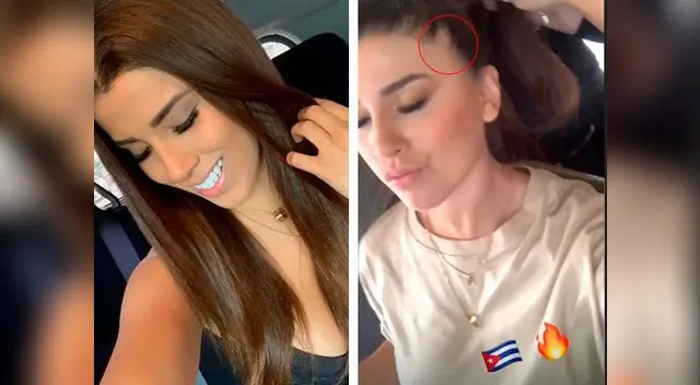 Yahaira Plasencia sufre caída de cabello y causa preocupación a sus fans Yahaira Plasencia sufre caída de cabello y causa preocupación a sus fans