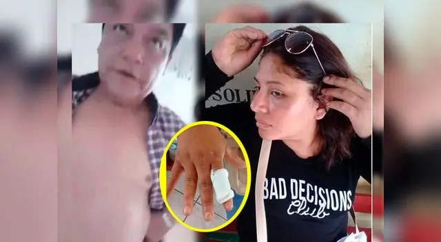 Sujeto mascar a golpes a ex pareja y le corta el dedo