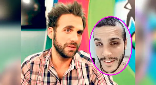 Como se recuerda, hace unas dos semanas, Mario Irivarren sorprendió al someterse a un implante de cabello. Como se recuerda, hace unas dos semanas, Mario Irivarren sorprendió al someterse a un implante de cabello.