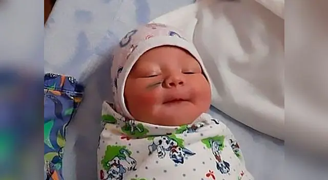 La recién nacida quedó con una tremenda cicatriz en su mejilla