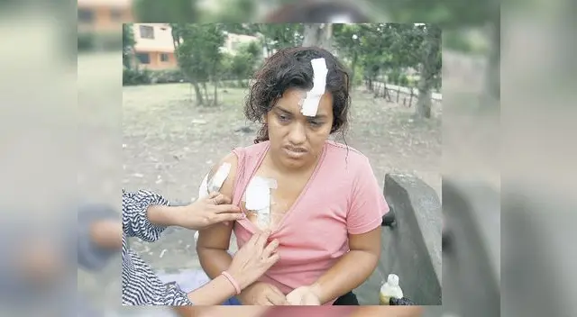 El hombre que le juraba amor la agredió una vez más El hombre que le juraba amor la agredió una vez más