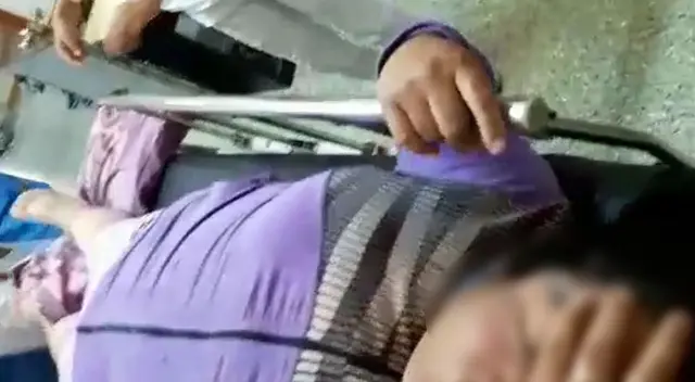 La mujer se fracturó la pierna derecha