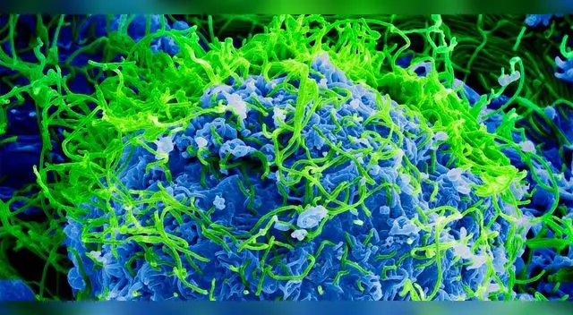 Según científicos el yaravirus ni siquiera sería reconocido como un agente viral Según científicos el yaravirus ni siquiera sería reconocido como un agente viral