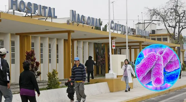 Hospital Cayetano Heredia: 8 niños son portadores de la bacteria KPC Hospital Cayetano Heredia: 8 niños son portadores de la bacteria KPC