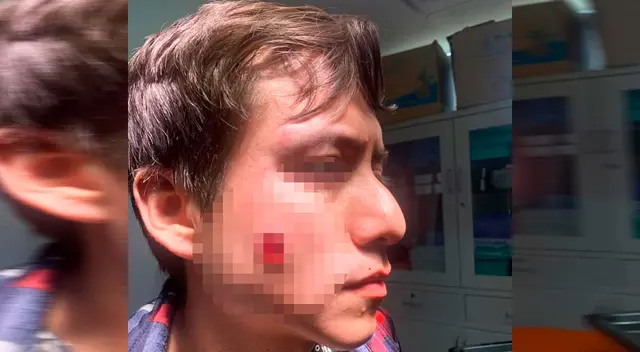 Agraviado con herida en la mejilla