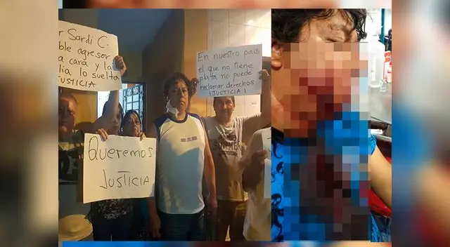 Desfiguran a padre de familia