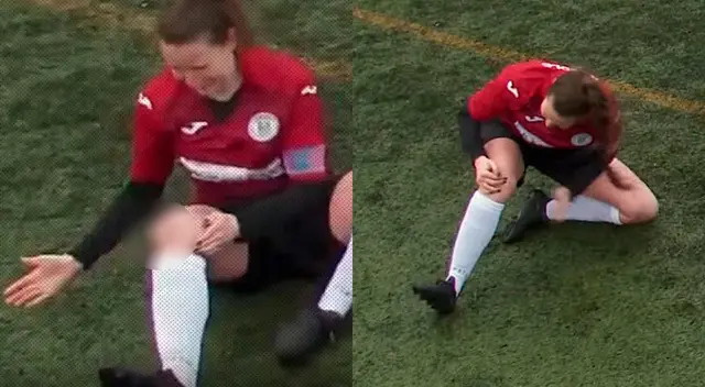 Jugadora sufrió lesión en pleno partido Jugadora sufrió lesión en pleno partido