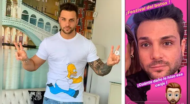 Peluchín se burla de Nicola Porcella por bótox. Peluchín se burla de Nicola Porcella por bótox.