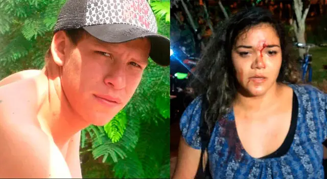 Ministerio Público investiga a Renato Gianniny Rodríguez Garassino por golpear salvajemente a su ex pareja Kiara Donayre Ministerio Público investiga a Renato Gianniny Rodríguez Garassino por golpear salvajemente a su ex pareja Kiara Donayre