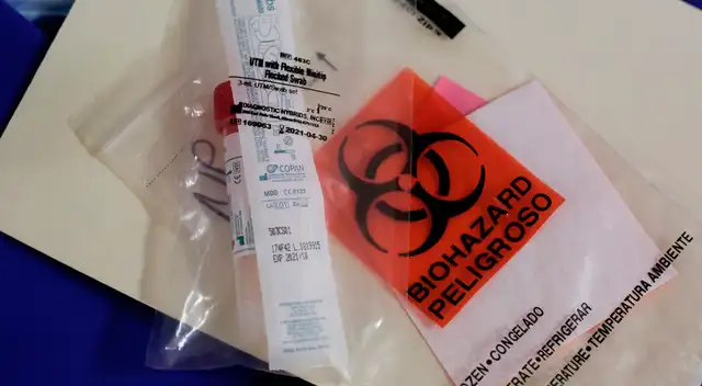 El kit ha sido exportado a Italia, Países Bajos y Austria. El kit ha sido exportado a Italia, Países Bajos y Austria.