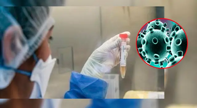 Análisis de muestra del coronavirus (imagen referencial)