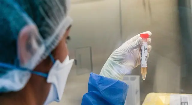 En la fase 3 es complejo hacer seguimiento a los nuevos casos de coronavirus.