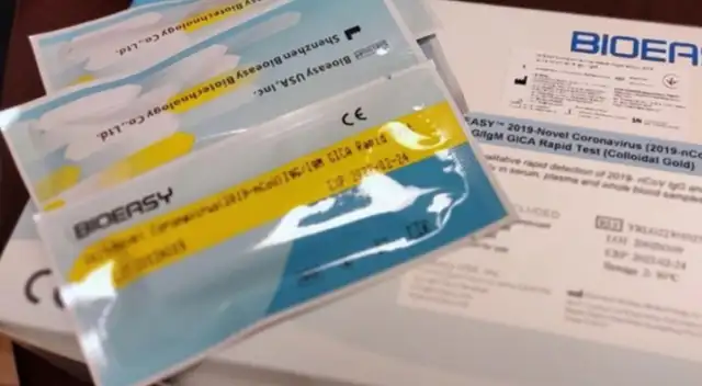 Los tests comprados a China fueron en total 8.000 pruebas.