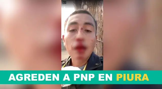 PNP fue agredido en pleno estado de emergencia. PNP fue agredido en pleno estado de emergencia.
