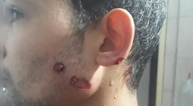 Este terrible hecho ocurrió en en el barrio Malvinas Argentinas de General Pico.