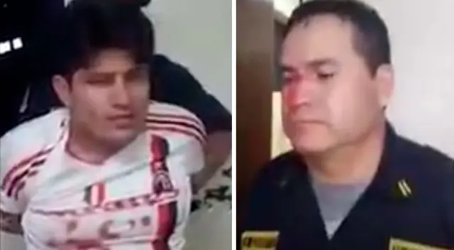 “He sido agredido por el señor quien no cumplió el Estado de Emergencia”, dijo el técnico frente a su agresor.