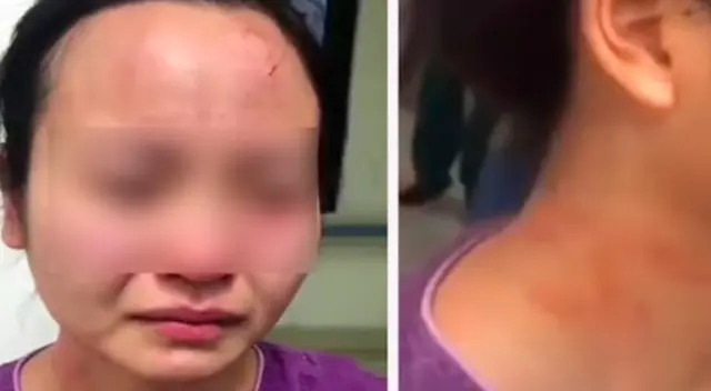 El hombre indignó a todos en China por su violento comportamiento hacia una enfermera. El hombre indignó a todos en China por su violento comportamiento hacia una enfermera.