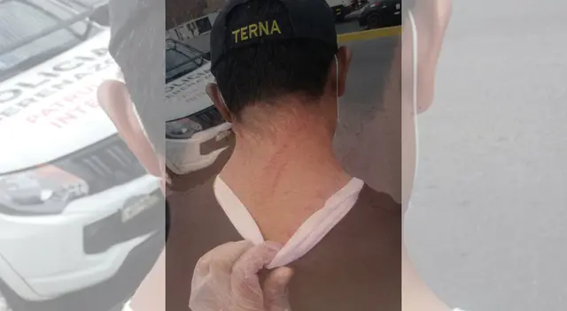 Efectivo de la PNP agredido en pleno estado de emergencia. Efectivo de la PNP agredido en pleno estado de emergencia.