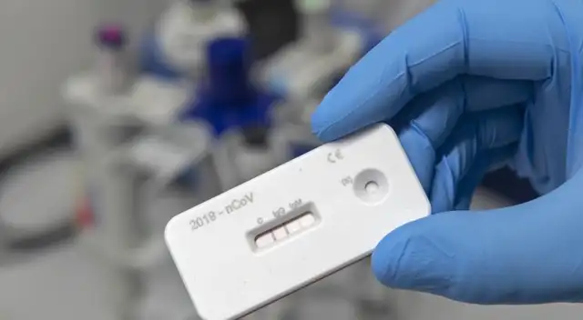 La mayoría de personas que han pasado la infección por el coronavirus no lo saben.