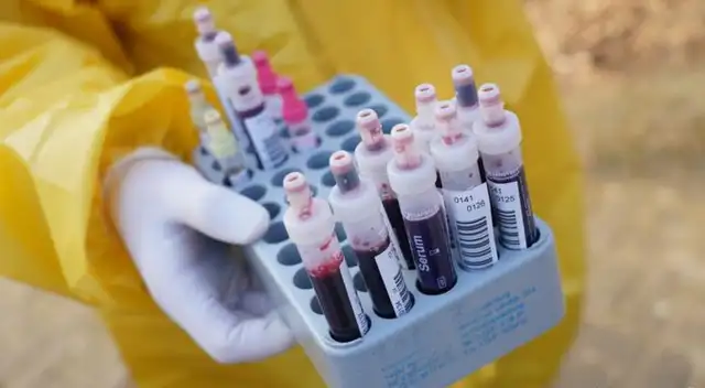 La mayoría de personas que han pasado la infección por el coronavirus no lo saben.