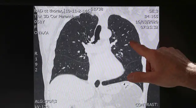 Las medidas que ha tomado el gobierno, es la única que se debe acatar ante el desconocimiento médico sobre este virus, que hasta el momento no tiene cura ni tratamiento para combatirla.