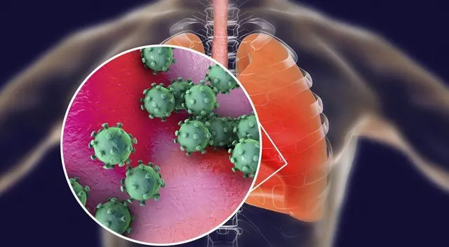 Cuando el virus afecta el sistema de respiración, se reduce la capacidad del cuerpo para poder tomar oxígeno y exhalar el dióxido de carbono.