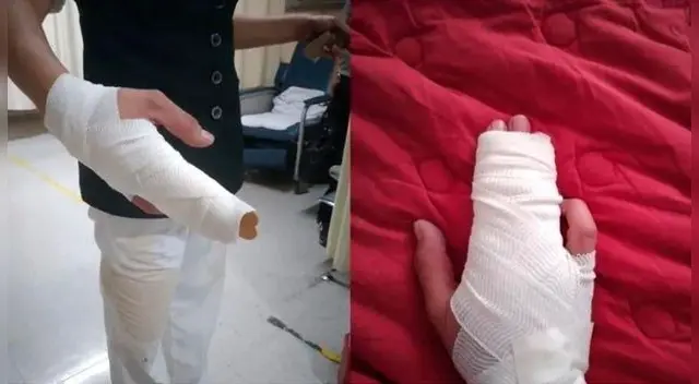 Al tratar de evadir la agresión, Sandra, sufrió fracturas en dos dedos. Al tratar de evadir la agresión, Sandra, sufrió fracturas en dos dedos.