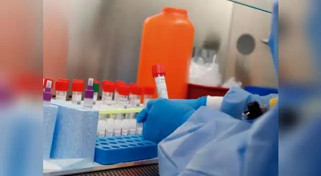 Coronavirus en Perú EN VIVO