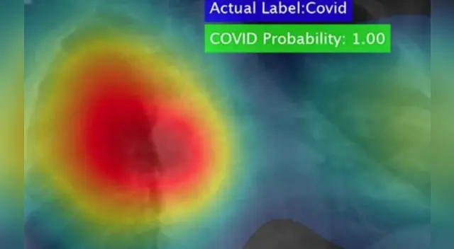 El código software detecta el coronavirus con un 98% de efectividad.