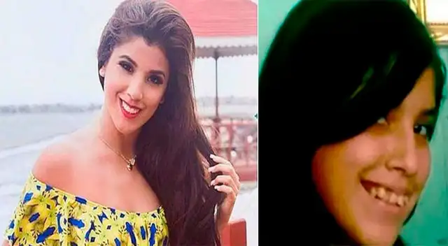 Yahaira Plasencia cuenta historia del diente que le faltaba.