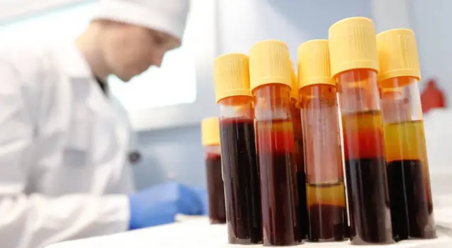 Johnson & Johnson ha trabajado en la vacuna contra el coronavirus desde enero.