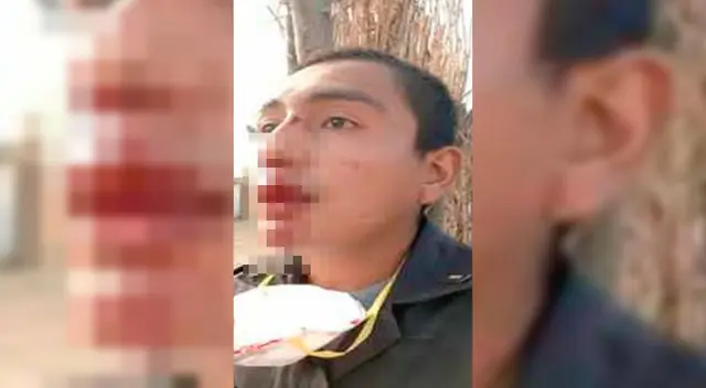 Soldado agredido. Soldado agredido.