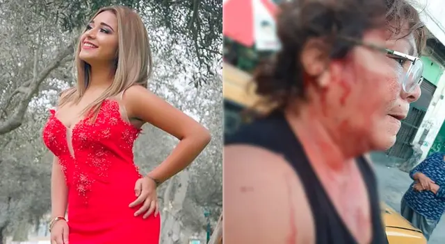 Gianella Ydoña denunciada por agredir físicamente a tía de Josimar