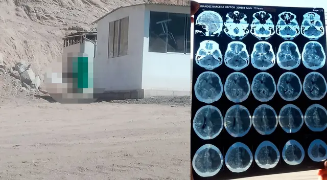 Denuncian negligencia médica en Cienegilla