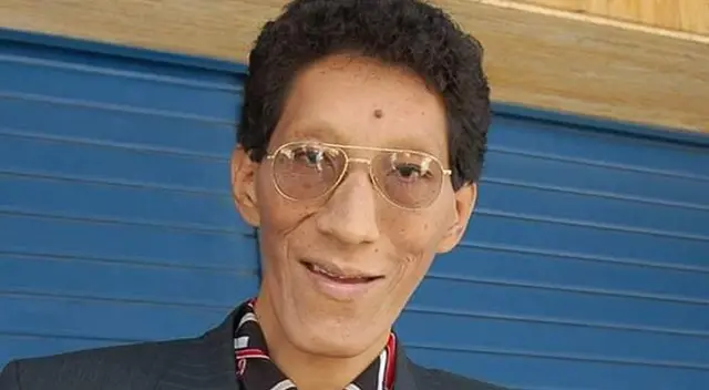 Murió el hombre más alto del Perú. Murió el hombre más alto del Perú.