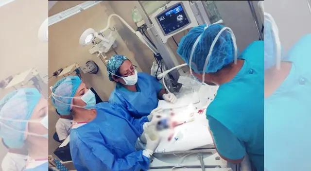 Bebé prematura salva de morir. Bebé prematura salva de morir.