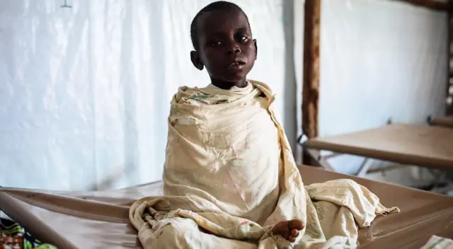 África ha reportado hasta la fecha más de 28 mil casos de coronavirus y alrededor de 13.308 fallecidos.