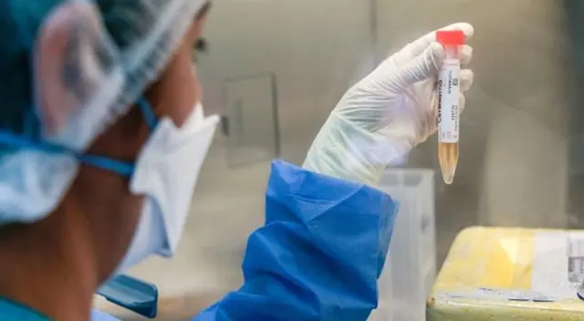 Casos de coronavirus ascendieron a 25 331. Casos de coronavirus ascendieron a 25 331.