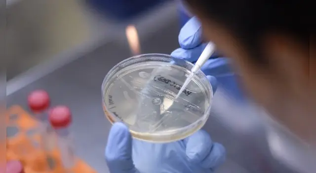 Aún hay esperanzas de que los ensayos de la vacuna para combatir el covid-19 se producirán entre 12 a 18 meses, indicó Berkley. Aún hay esperanzas de que los ensayos de la vacuna para combatir el covid-19 se producirán entre 12 a 18 meses, indicó Berkley.