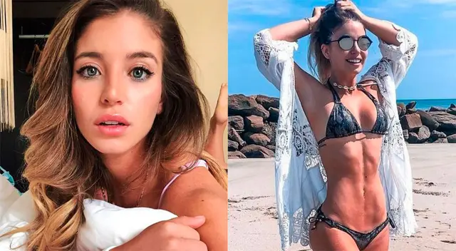 Flavia Laos muestra su rostro inflamado en Instagram. Flavia Laos muestra su rostro inflamado en Instagram.