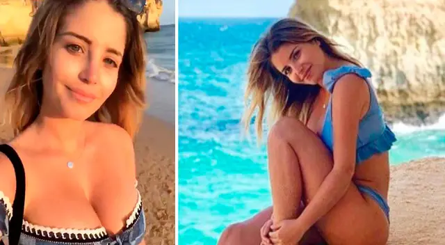 Flavia Laos muestra su rostro inflamado en Instagram. Flavia Laos muestra su rostro inflamado en Instagram.