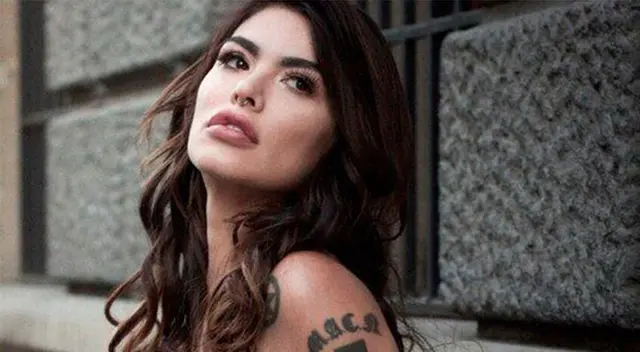 Angie Jibaja muestra cómo le curan las heridas. Angie Jibaja muestra cómo le curan las heridas.