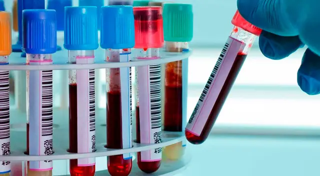 El tratamiento utilizará el plasma de pacientes curados del Covid-19. El tratamiento utilizará el plasma de pacientes curados del Covid-19.