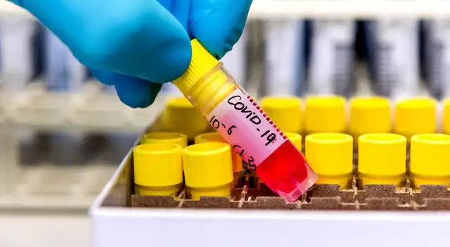 La terapia de Regeneron Pharmaceuticals Inc. consiste en administrar un cóctel de dos anticuerpos.