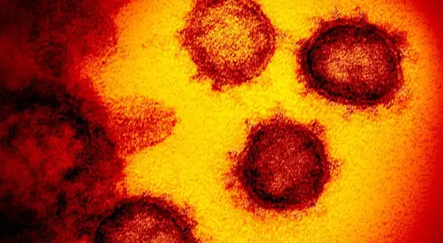 El virus COVID-19, visto al microscopio.