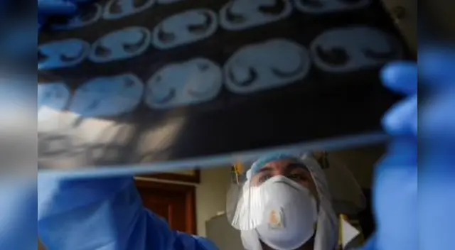 Los pacientes con coronavirus se le realizaron radiografías o tomografías computarizadas para descubrir el motivo del por qué las personas estaban falleciendo inesperadamente.